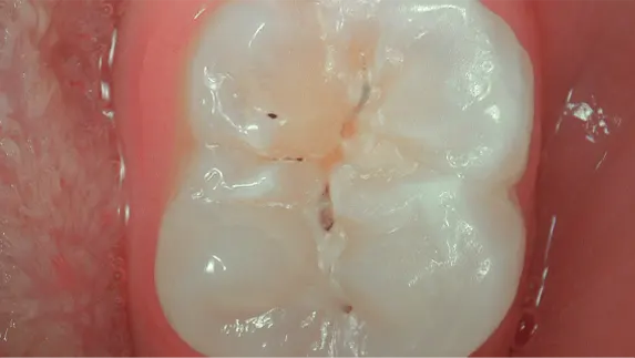 c50 intraoral camera daylight mode